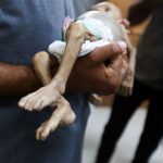 Hunger is Stealing Gaza’s Children A Human Tragedy That Could Be Stopped