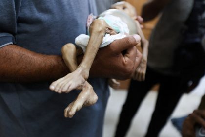 Hunger is Stealing Gaza’s Children A Human Tragedy That Could Be Stopped