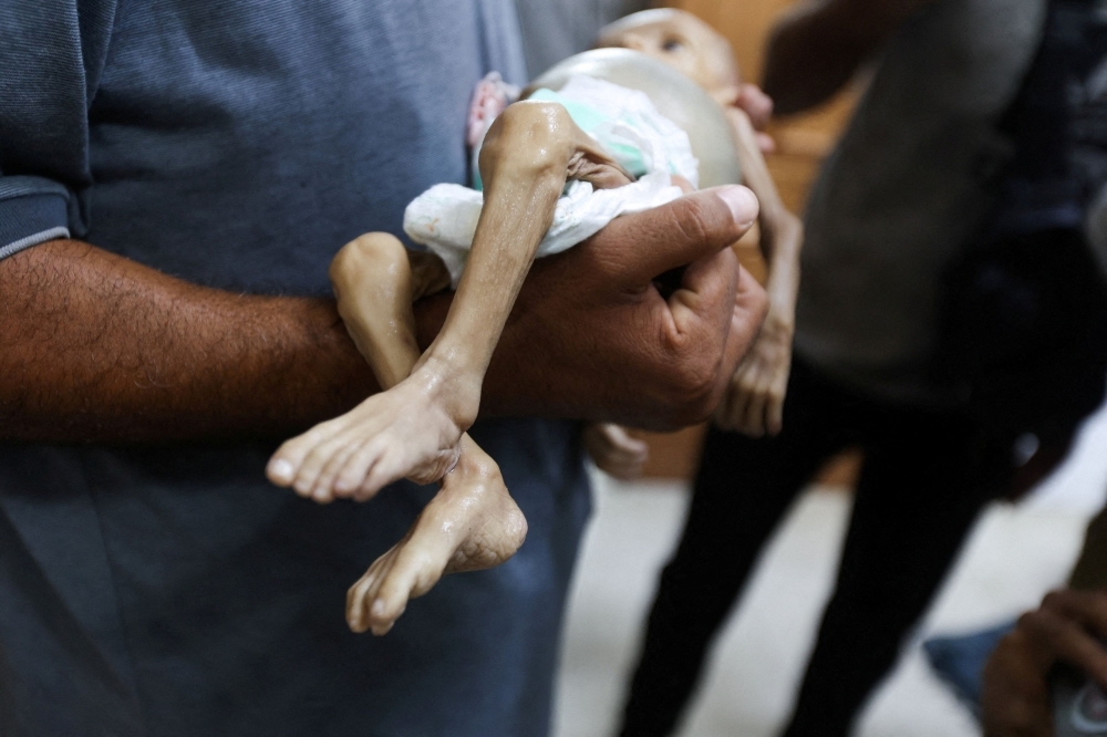 Hunger is Stealing Gaza’s Children A Human Tragedy That Could Be Stopped