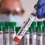 Third British Passenger Suspected In Hantavirus Scare Linked To Cruise Ship Outbreak