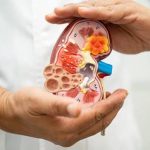 Parliament Panel Calls For Mandatory Kidney Tests From Age 20 A Major Push For Early Detection And Prevention